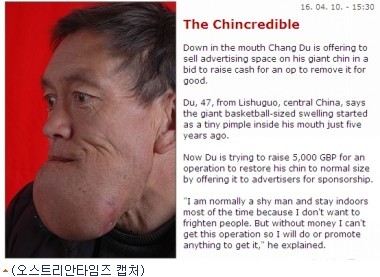 호진셀 이미지