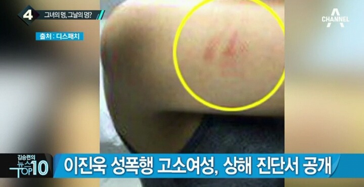 다시 보는 이진욱 고소인 상해진단서.jpg | 인스티즈