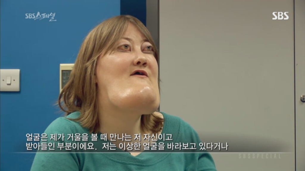 기형적 턱을 가진 여자 비키 라이트가 성형수술을 하지 않는 이유 | 인스티즈