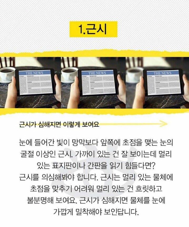 눈으로 알 수 있는 질병 | 인스티즈