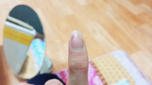 보기만 해도 고통이 전해지는 사진 | 인스티즈