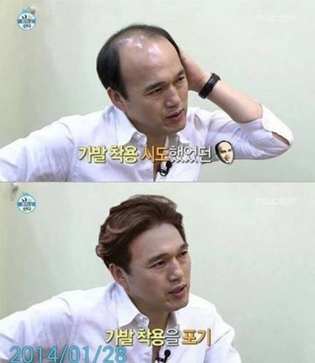 키 178cm + 서울대 졸업 + 입사 9년 차 은행원 + 3억 8천만 원 아파트 소유 스펙인데도 대머리면 까인다는 현실 (소리) | 인스티즈