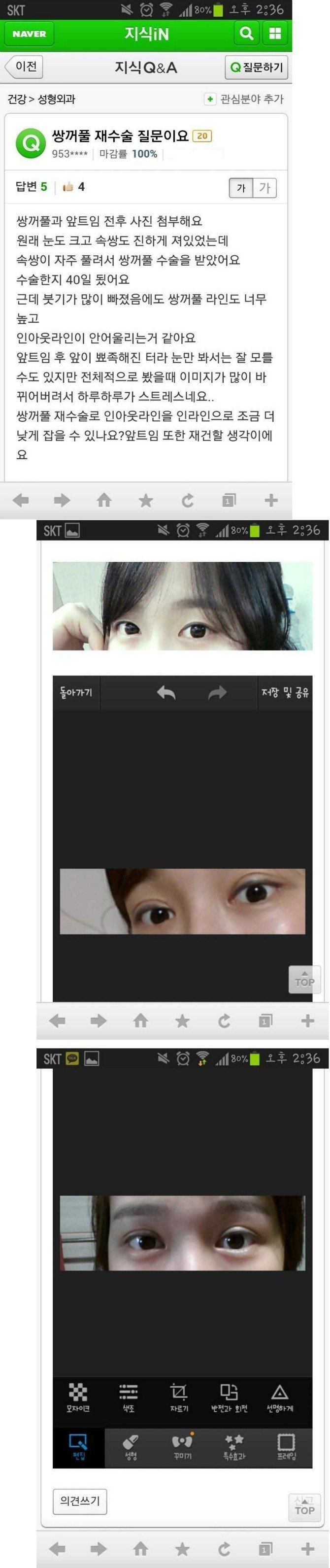 쌍꺼풀 수술 후회하는 여자 | 인스티즈