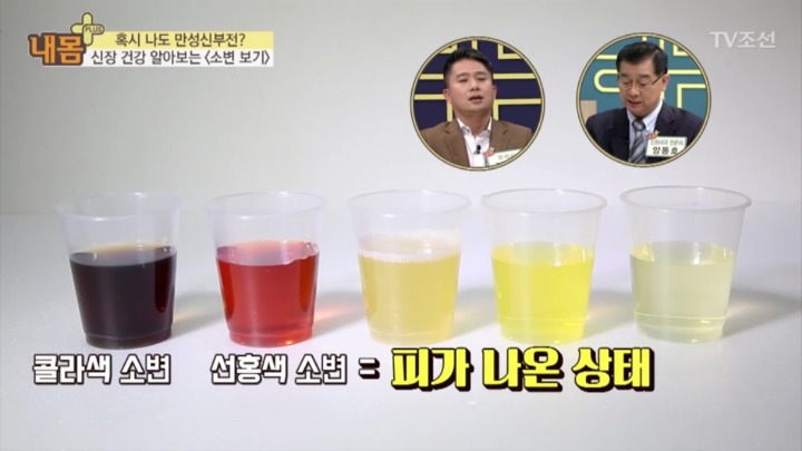 소변 색으로 보는 신장 건강 | 인스티즈