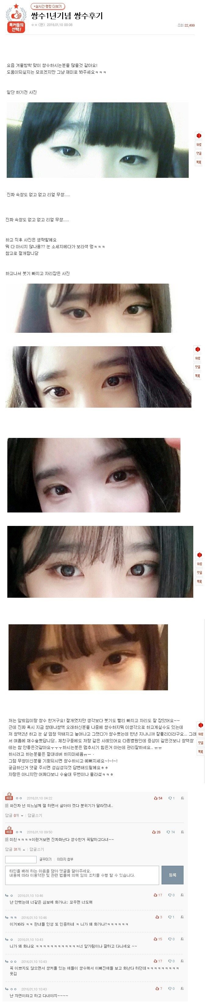 쌍수하는 이유.jpg | 인스티즈