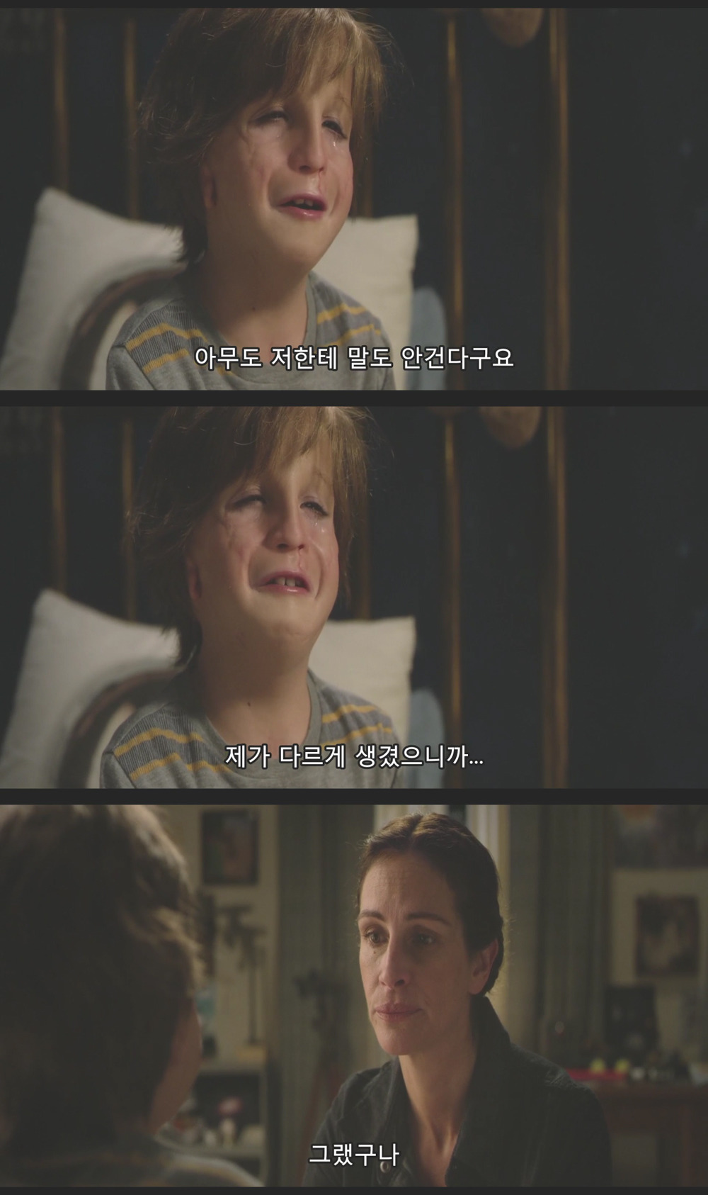안면기형으로 태어났는데 애들이 너무 괴롭혀서 학교에 가기 싫어요...... jpg | 인스티즈