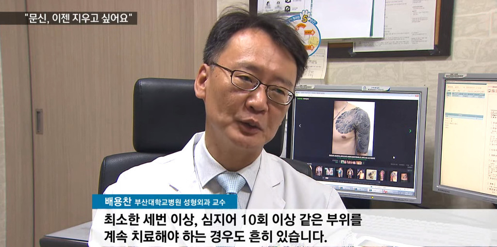문신, 이제 지우고 싶어요! | 인스티즈
