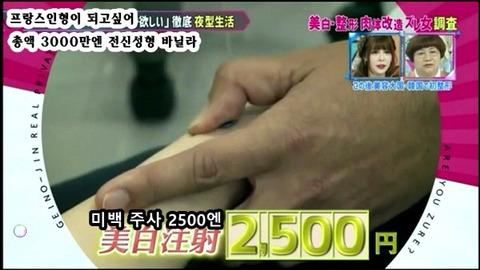 프랑스 인형이 되고싶어 총액 3000만엔 전신성형한 바닐라 | 인스티즈